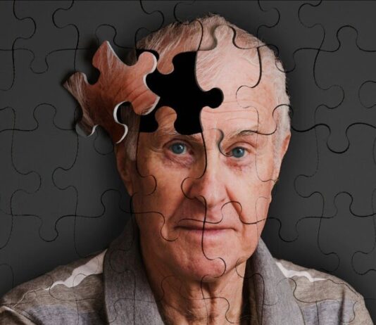 Bilim dünyasından tarihi buluş: Alzheimer tedavisinde dönüm noktası